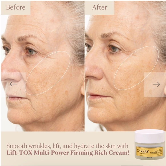Nakery Beauty LiftTox MultiPower Firming Rich Cream younger in as few as 3 days - Picture 7 of 11